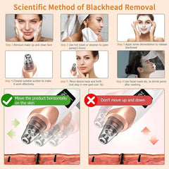 5 in 1 Blackhead Remover Vacuum