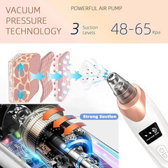 5 in 1 Blackhead Remover Vacuum