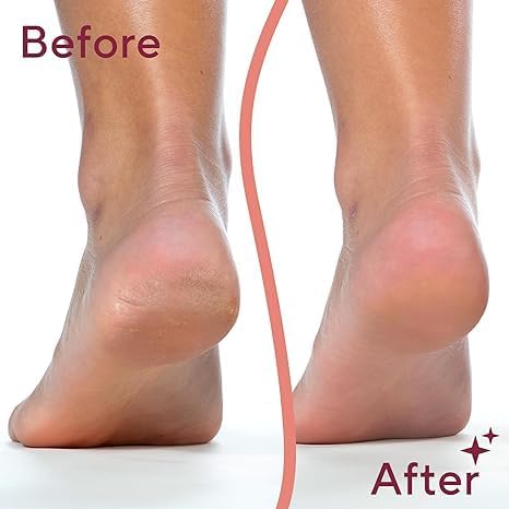 Flawless Pedi | The Ultimate Electronic Foot