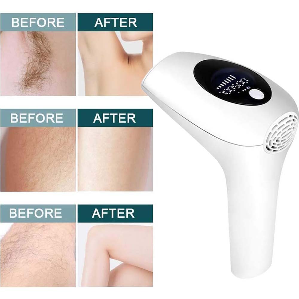 Laser Hair Removal System with 900,000 Flashes