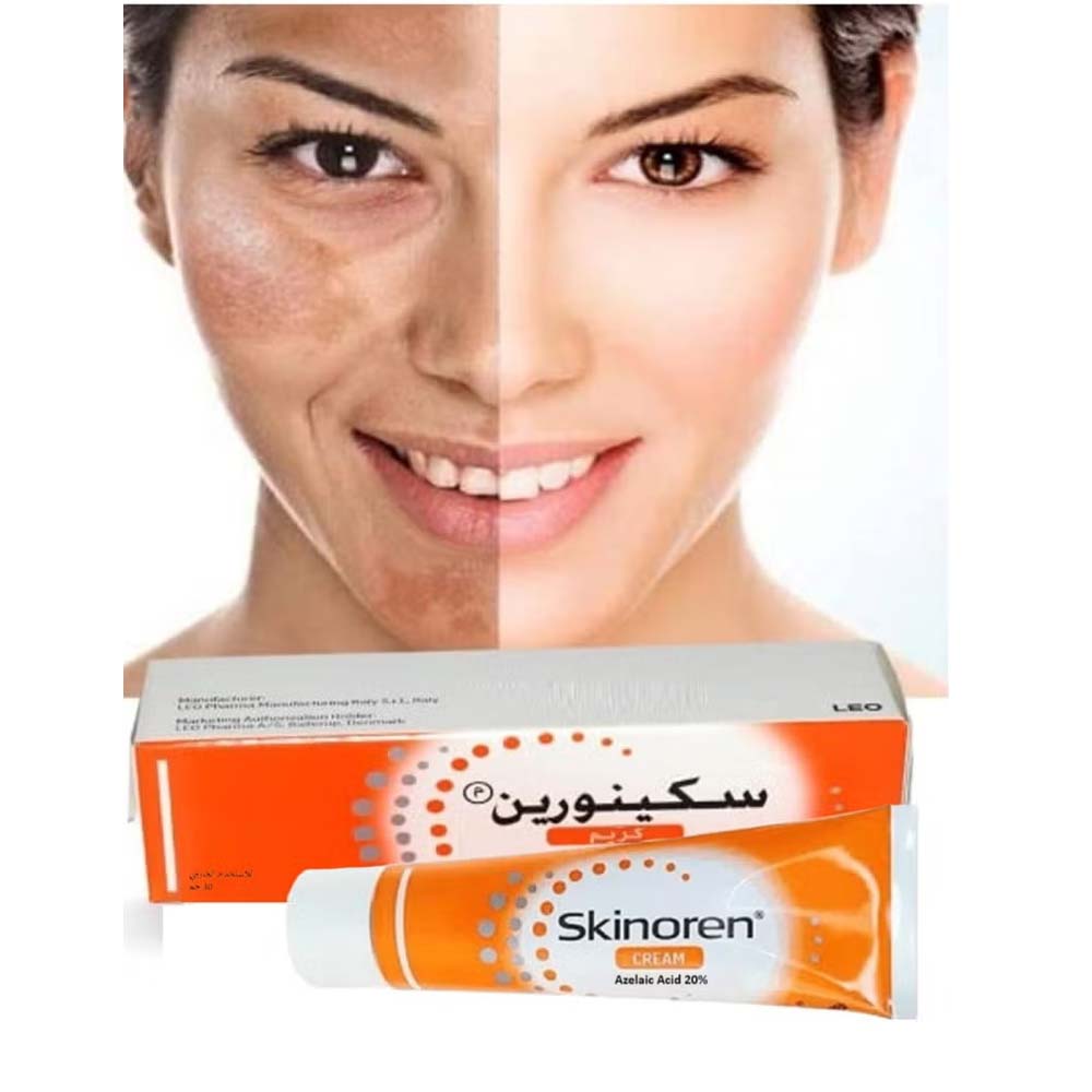 Skinoren Acne Treatment & Whitening Cream