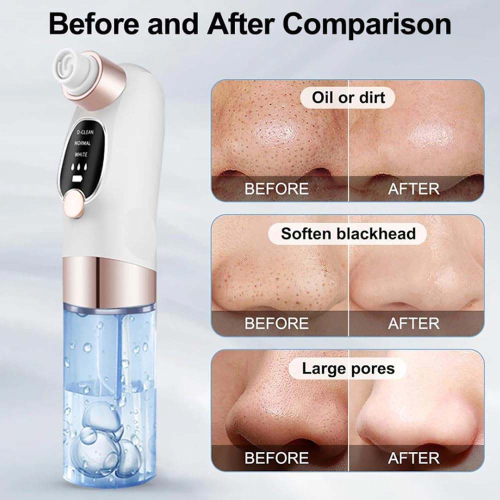 Blackhead Suction Remover Vacuum Pore Cleaner