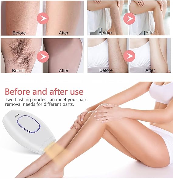 Home Use IPL Beauty Device