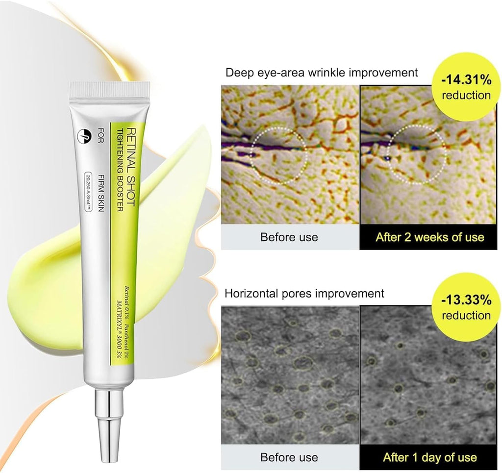 Vita A Retinal Shot Tightening Booster