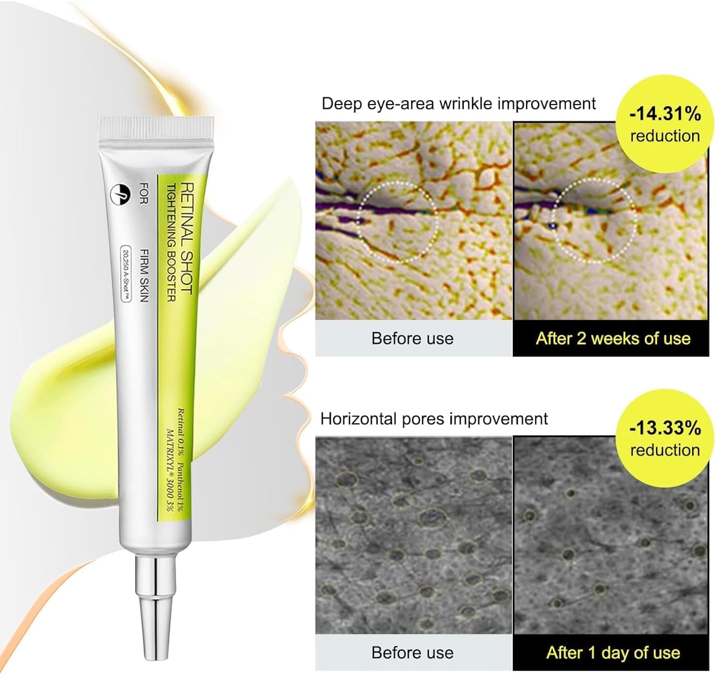 Vita A Retinal Shot Tightening Booster