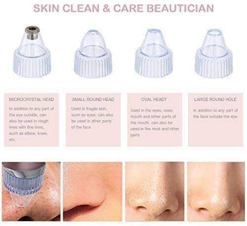 Blackhead & Whitehead Remover Electric