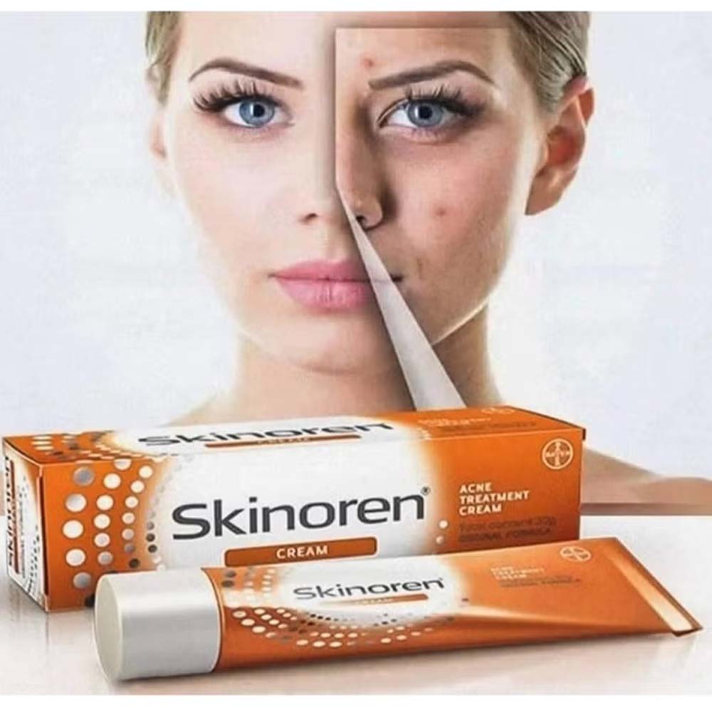Skinoren Acne Treatment & Whitening Cream