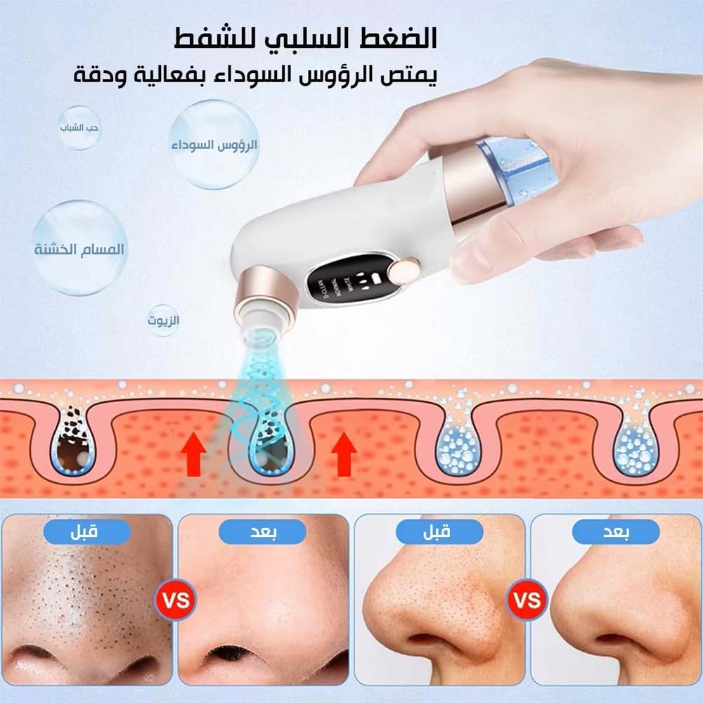 Blackhead Suction Remover Vacuum Pore Cleaner