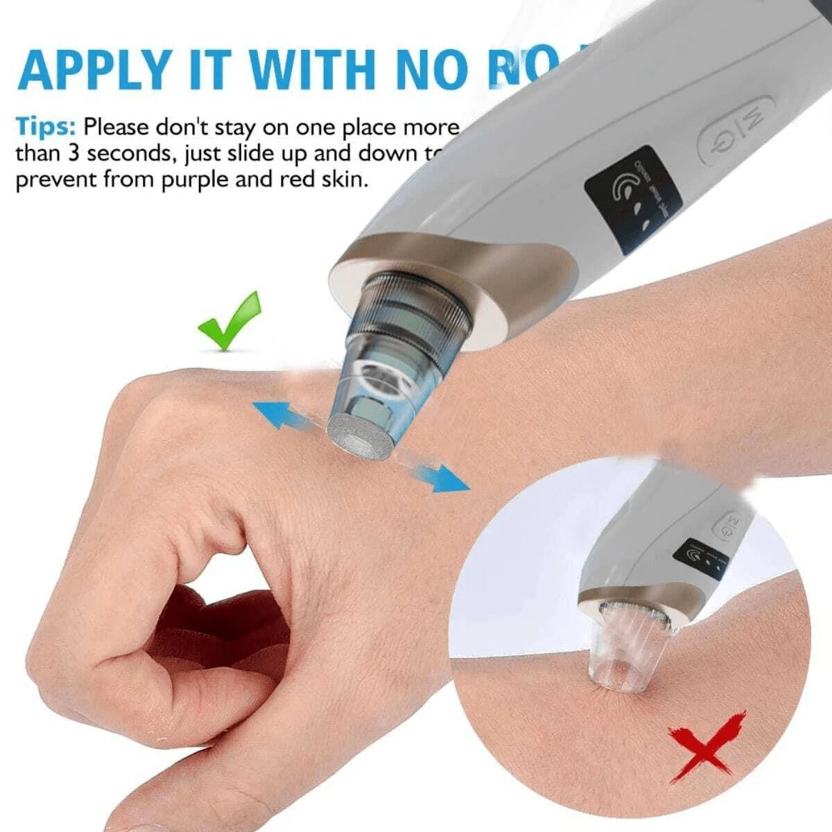 Electric Blackhead Vacuum Remover