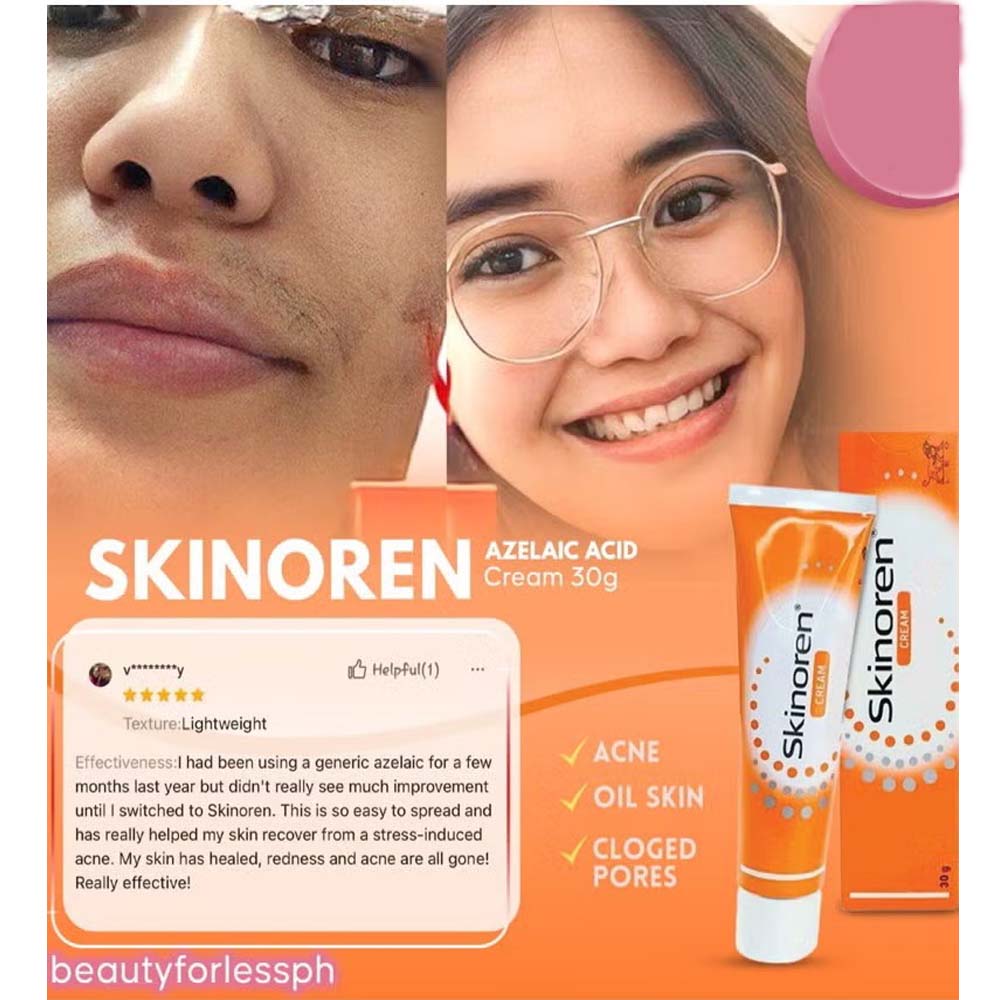 Skinoren Acne Treatment & Whitening Cream