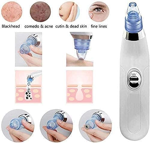 Blackhead & Whitehead Remover Electric
