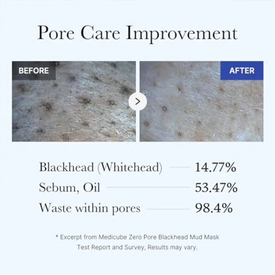 Zero Pore Black Mud Facial Mask
