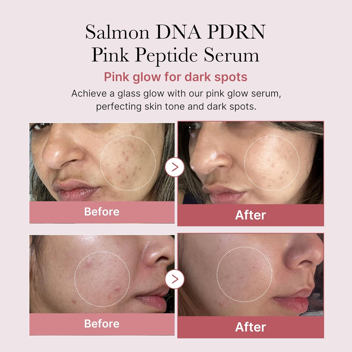 Medicube PDRN Pink Peptide Serum with Niacinamide