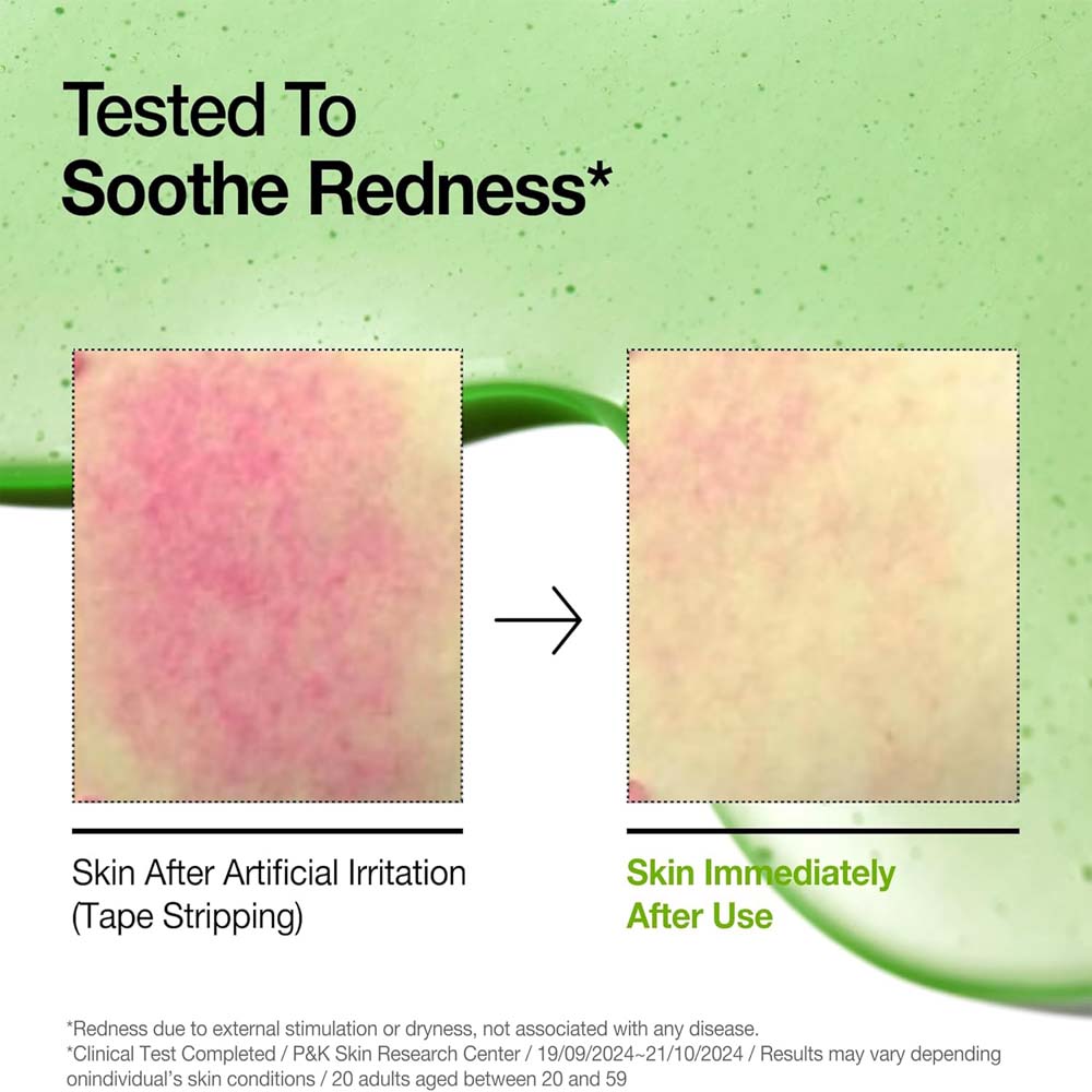 Anua Azelaic Acid 10 Soothing Serum with Hyaluronic Acid